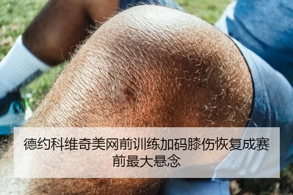 德约科维奇美网前训练加码膝伤恢复成赛前最大悬念